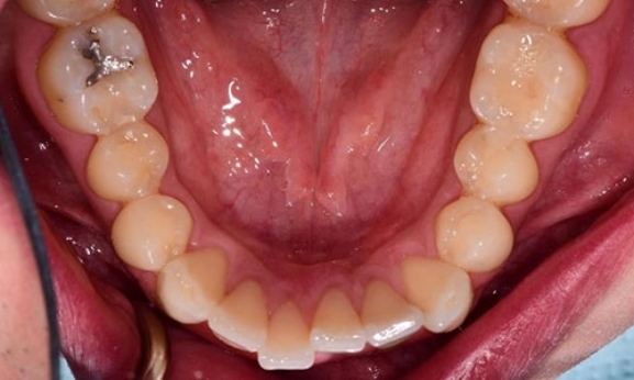 Pinebrook Dentistry smile-gallery-before